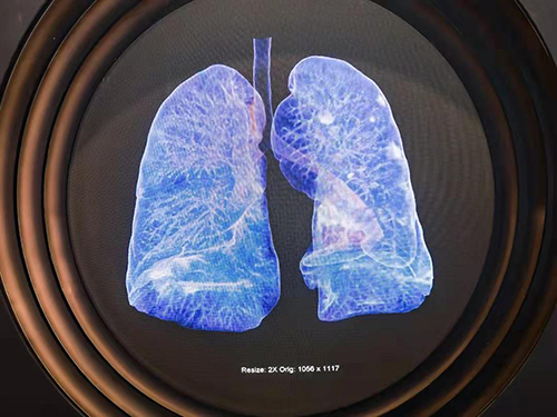 西门子生化是什么·保险、基金、银行纷纷布局养老金融，将对百姓产生什么影响？_https://www.jmylbn.com_新闻资讯_第2张