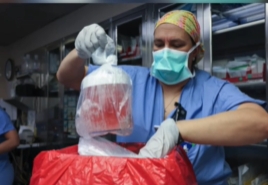 美医院完成全球首例活体人类移植猪肾脏手术